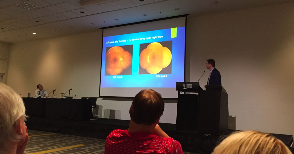 Dr Michael Chilov and Dr Adrian Fung have presented lectures at the Royal Australian and New Zealand College of Ophthalmologists’ (RANZCOs’) 46th Annual Scientific Congress in Brisbane.